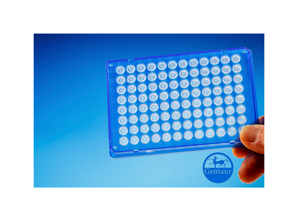 ELISA   96-Well Cell Culture Plate, Black, with Clear Flat-Bottom, TC-Treated